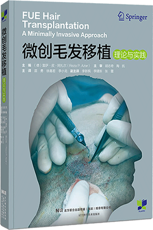 FUE Hair Transplantation