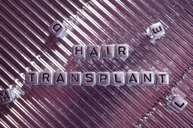 Anwendung der I-FUE-Haartransplantation im Überblick