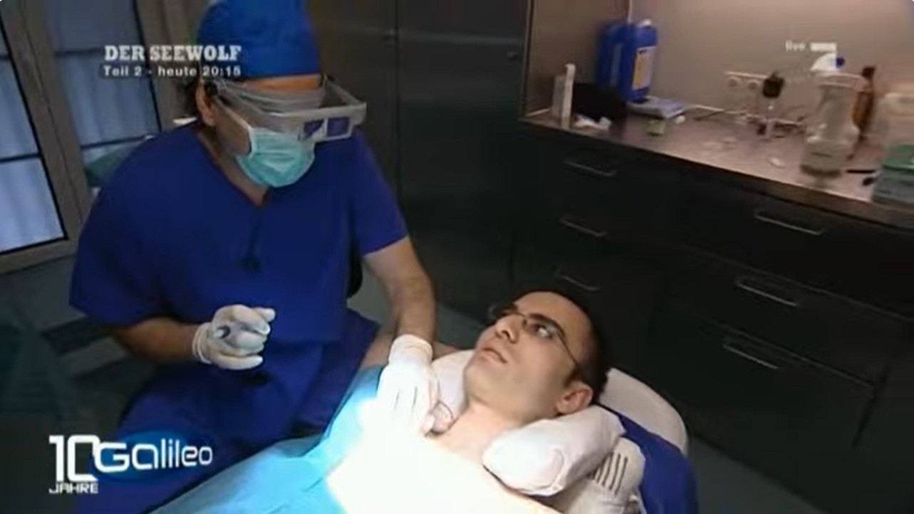 Galileo-Bericht über das Zentrum für moderne Haartransplantation in Berlin